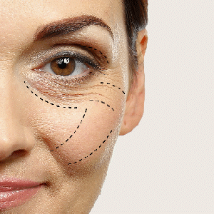 Smooth Fine Lines