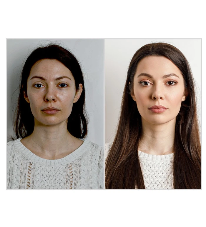 Before After Result