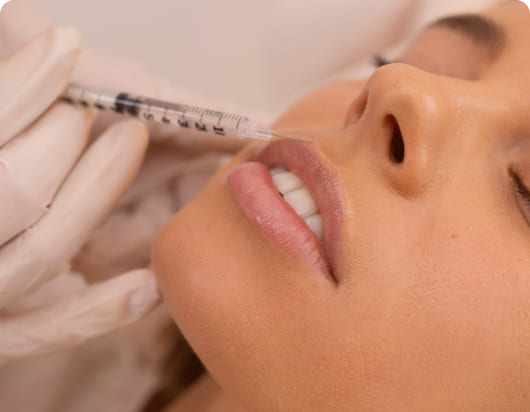 Fillers