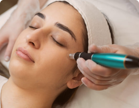 Microneedling